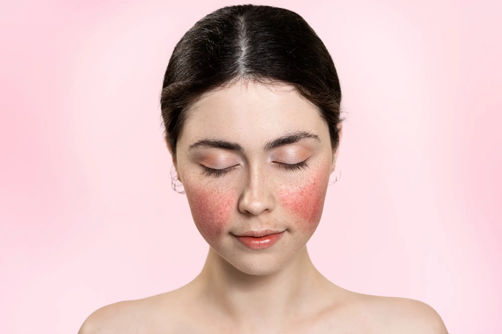 Client with a chronic skin condition
